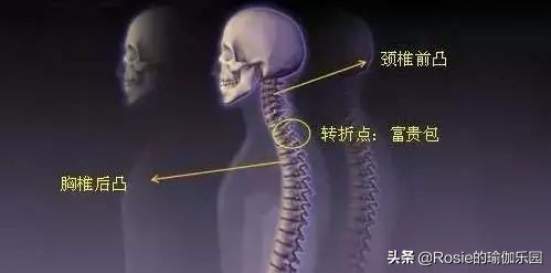 女人脖子后面的富贵包是什么原因,脖子后面有富贵包怎么让它消除