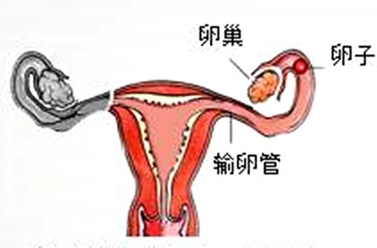 卵巢囊肿有几种手术方案,卵巢囊肿怎么动手术