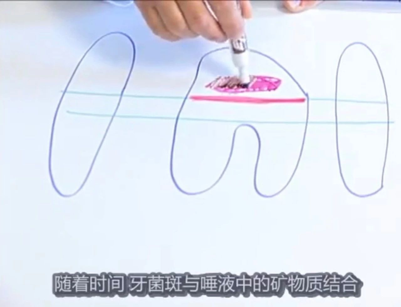 猫有牙周炎该怎么治疗,猫有牙龈炎怎么治疗