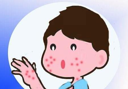 湿疹问题在哪里,湿疹症状健康科普