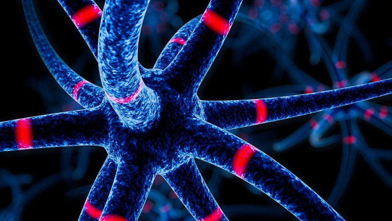 多发性硬化症发病多少年后恶化,多发性硬化症发病