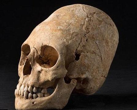 古代枕骨穿孔风俗,传承千年的民间习俗