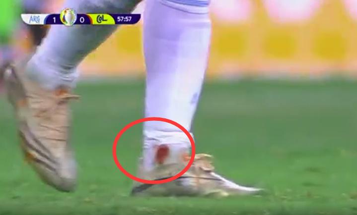 马丁内斯扑出点球阿根廷队员反应,马丁内斯扑出3个点球