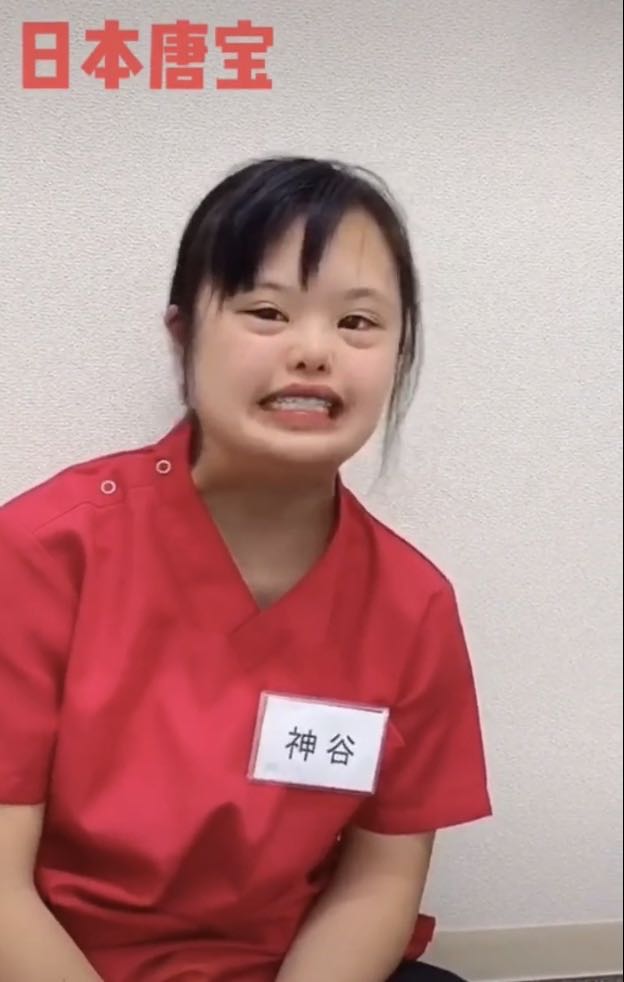 唐氏胎儿眼距一般多宽,唐氏胎儿眼距都宽吗