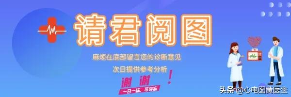 左前分支传导阻滞前胸痛怎么办,左前分支传导阻滞趋势