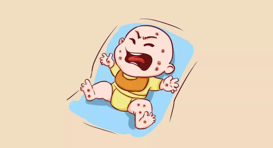 冬季如何预防宝宝湿疹反复？