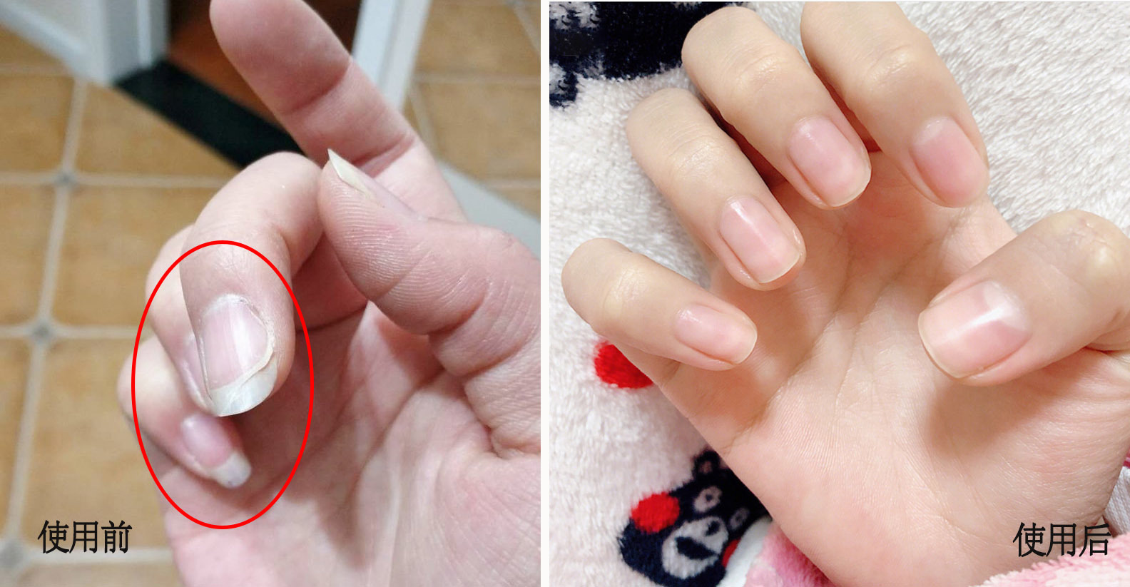 易劈易断还分层？美国专业沙龙修复甲油，给“病甲”快速“整容”