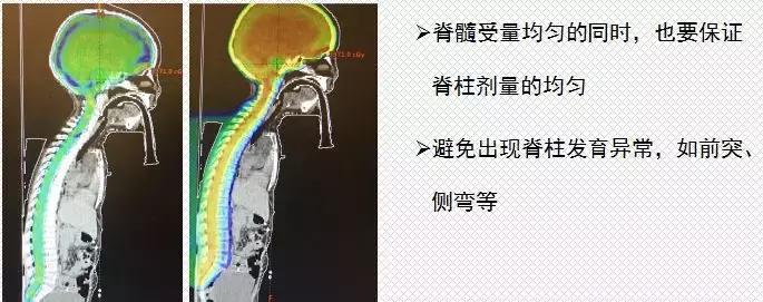 质子治疗适用于什么癌症,质子治疗癌症的疗效咋样