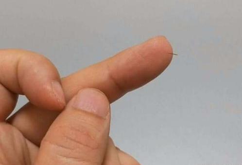 不用针挑刺的方法,怎么用针挑出刺