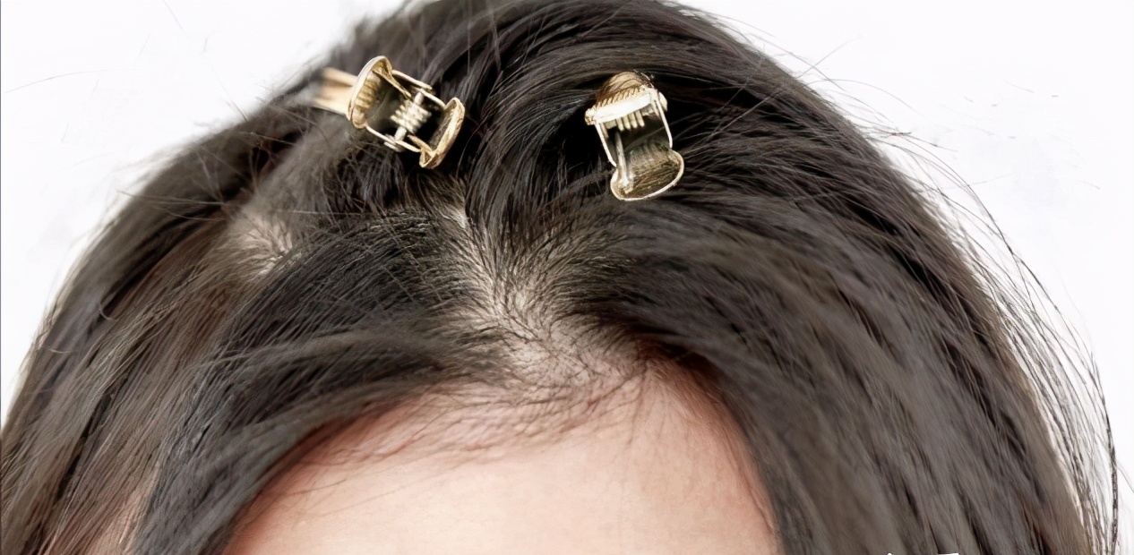 头顶塌自动卷发棒怎么烫蓬松,头顶塌发尾蓬松怎么办可以软化吗