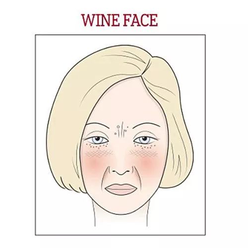 喝酒脸红风险,喝酒脸红的人有什么生命危险