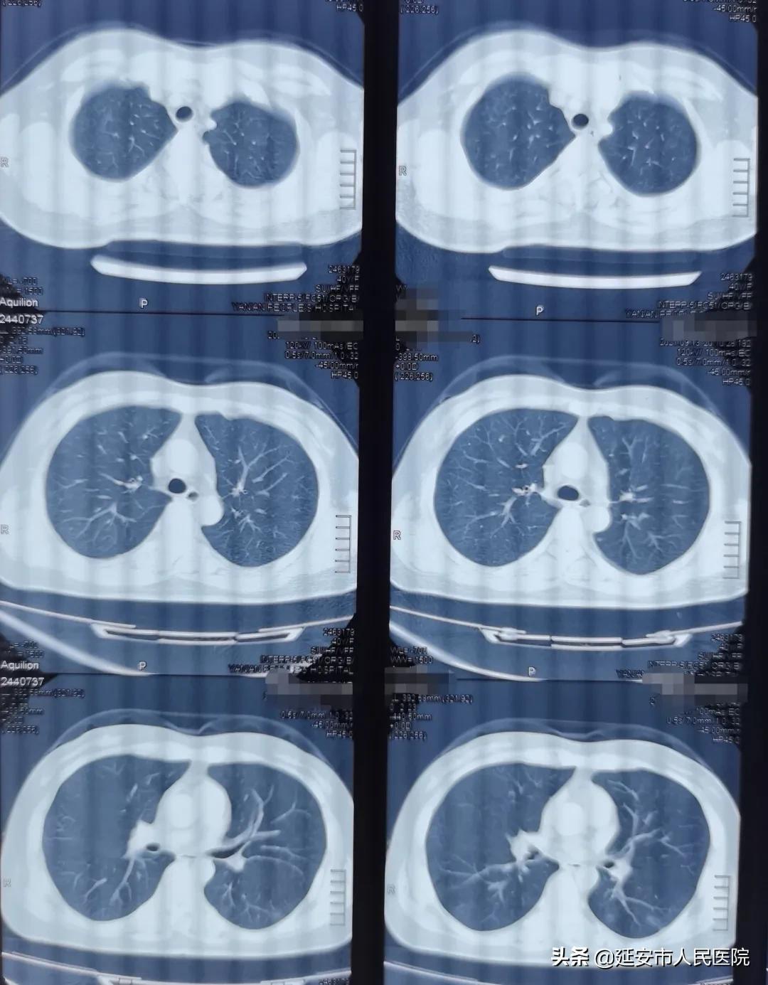 閮戦攼鏁戞湸鑽ｆ仼,閮戦攼鏁戞矆骞垮啗