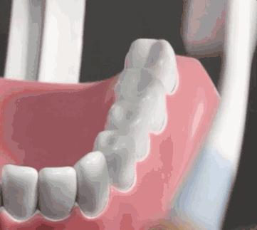 欧乐bd12电动牙刷刷牙正确方法,电动牙刷快速舒适刷牙的必备品