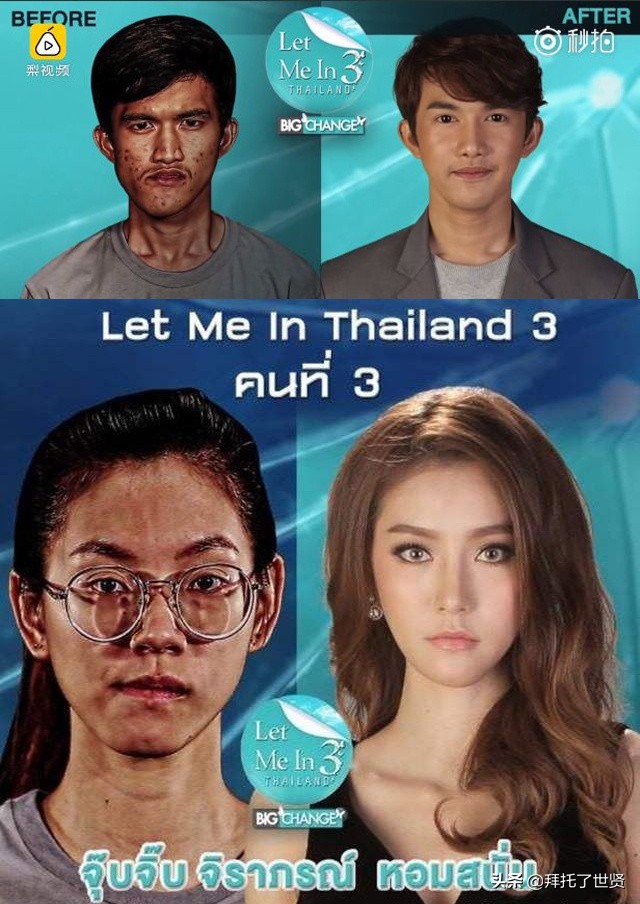 石原里美和佐藤健,石原里美整容之路