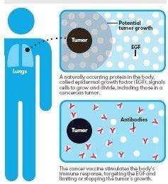 癌症疫苗将问世是真的吗,癌症疫苗或将问世