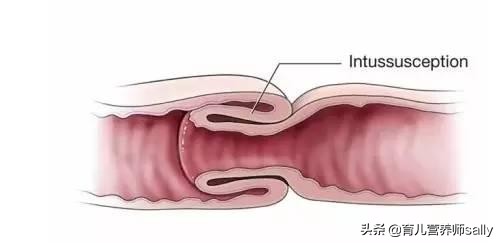 宝宝玩的好好的突然大哭,宝宝玩的好好的突然肚子剧痛