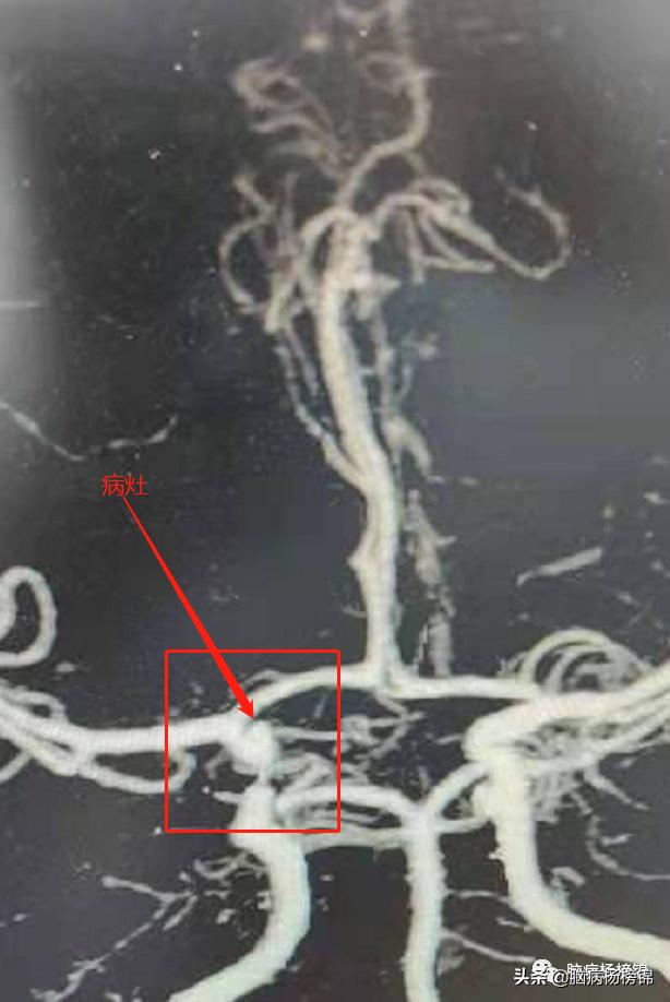 意外伤害很严重年纪轻轻难保命，谭院刀刀用真情豫南名医中中中