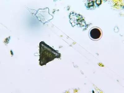 水产养殖藻类老化是怎样的,水产养殖显微镜下各种藻类