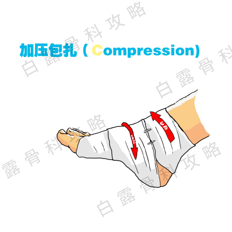 崴脚后48小时紧急处理,崴到脚紧急处理