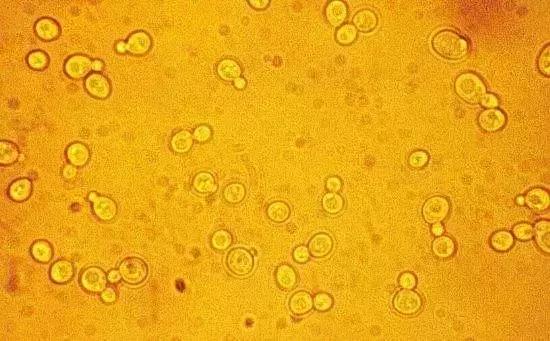 酵素肥料骗局,橙子酵素肥料