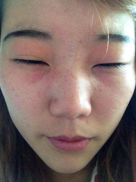 为什么不建议种下睫毛,为什么不要去种睫毛