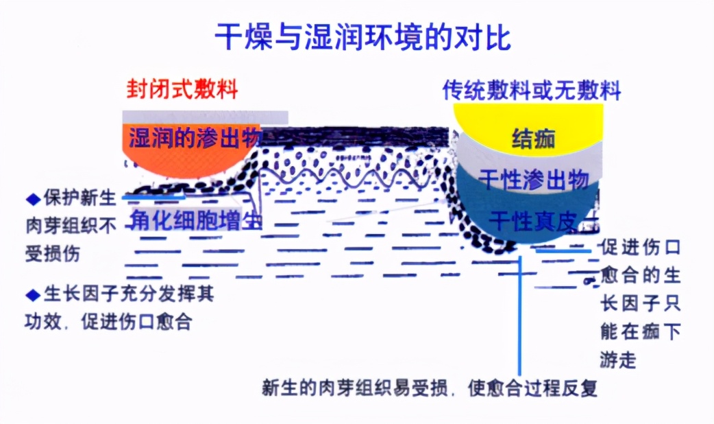 手术伤口愈合后怎么护理好得快,怎么护理伤口的视频