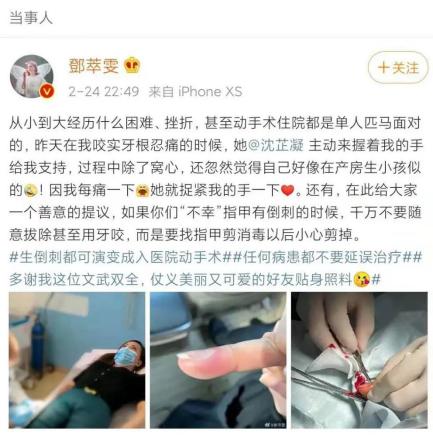 明星手扎倒刺去医院,女明星手上长了倒刺拔了后住院