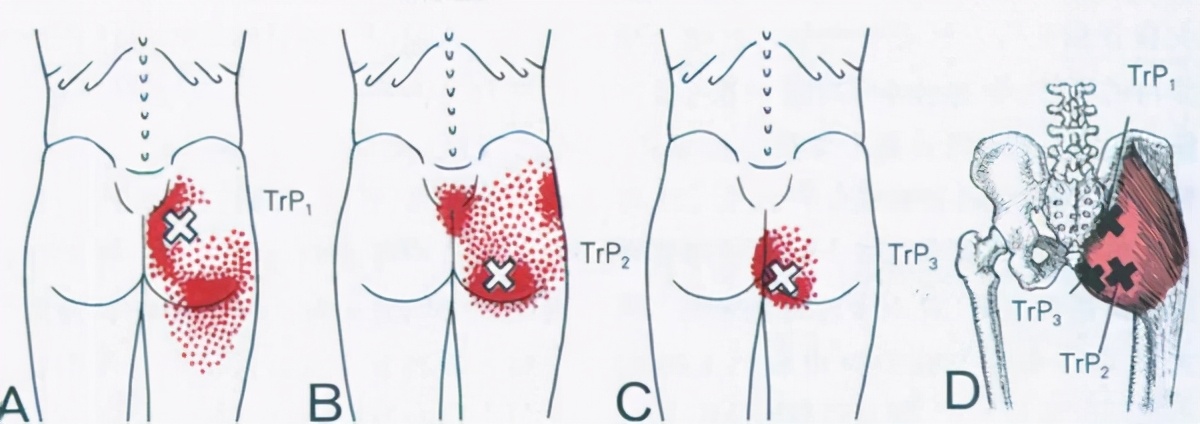 久坐后腰骶骨疼的厉害,久坐之后躺在床上腰骶部痛