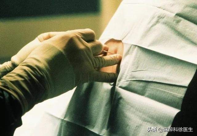 打麻醉是什么体验,半身麻醉多长时间恢复感觉