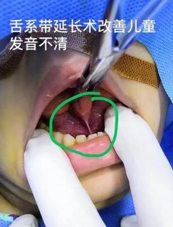 口腔科医院只看口腔病吗,口腔科是看牙齿还是口腔疾病