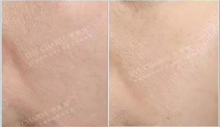 伊肤泉小白瓶怎么那么便宜,上市首月狂卖12000台