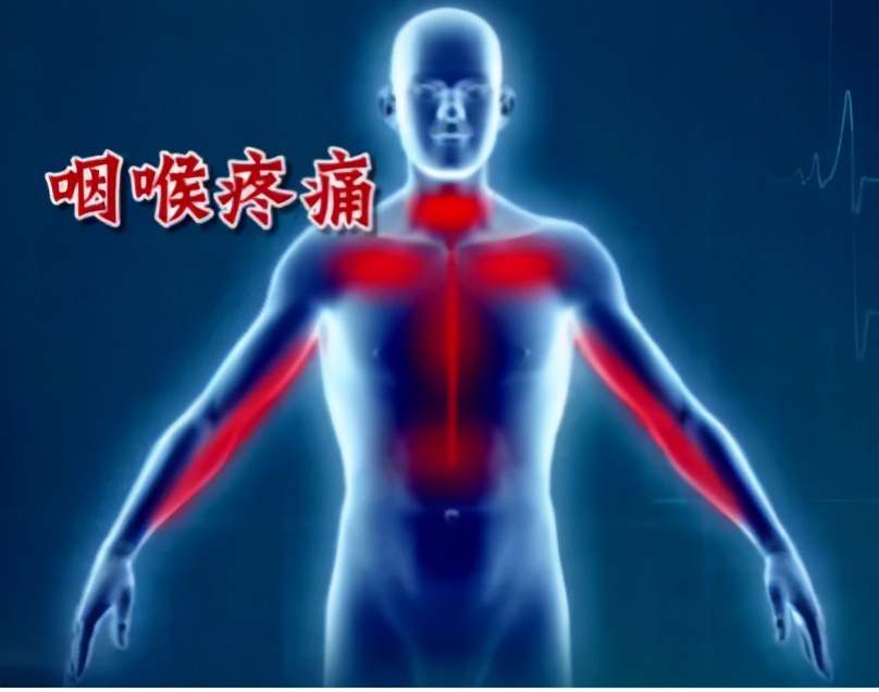 没有征兆而突发心梗有多可怕,哪些地方疼会是心梗的前兆