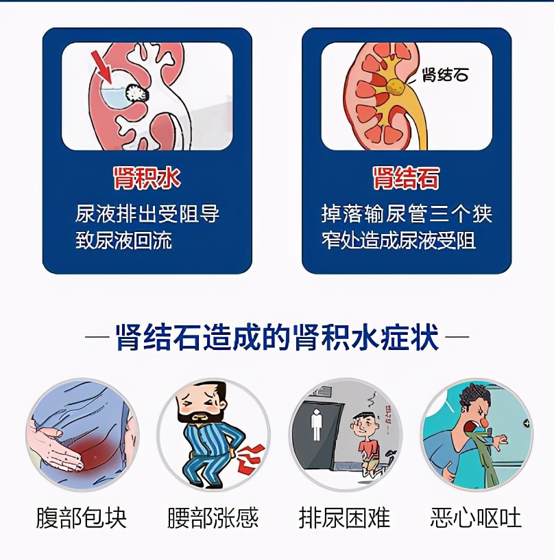 肾结石尿尿疼痛怎么办,肾结石如果尿尿恢复正常还是很疼
