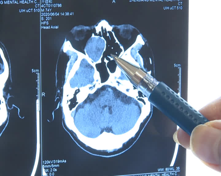 鼻子不舒服眼睛模糊怎么回事,鼻子干燥眼睛看东西模糊怎么回事