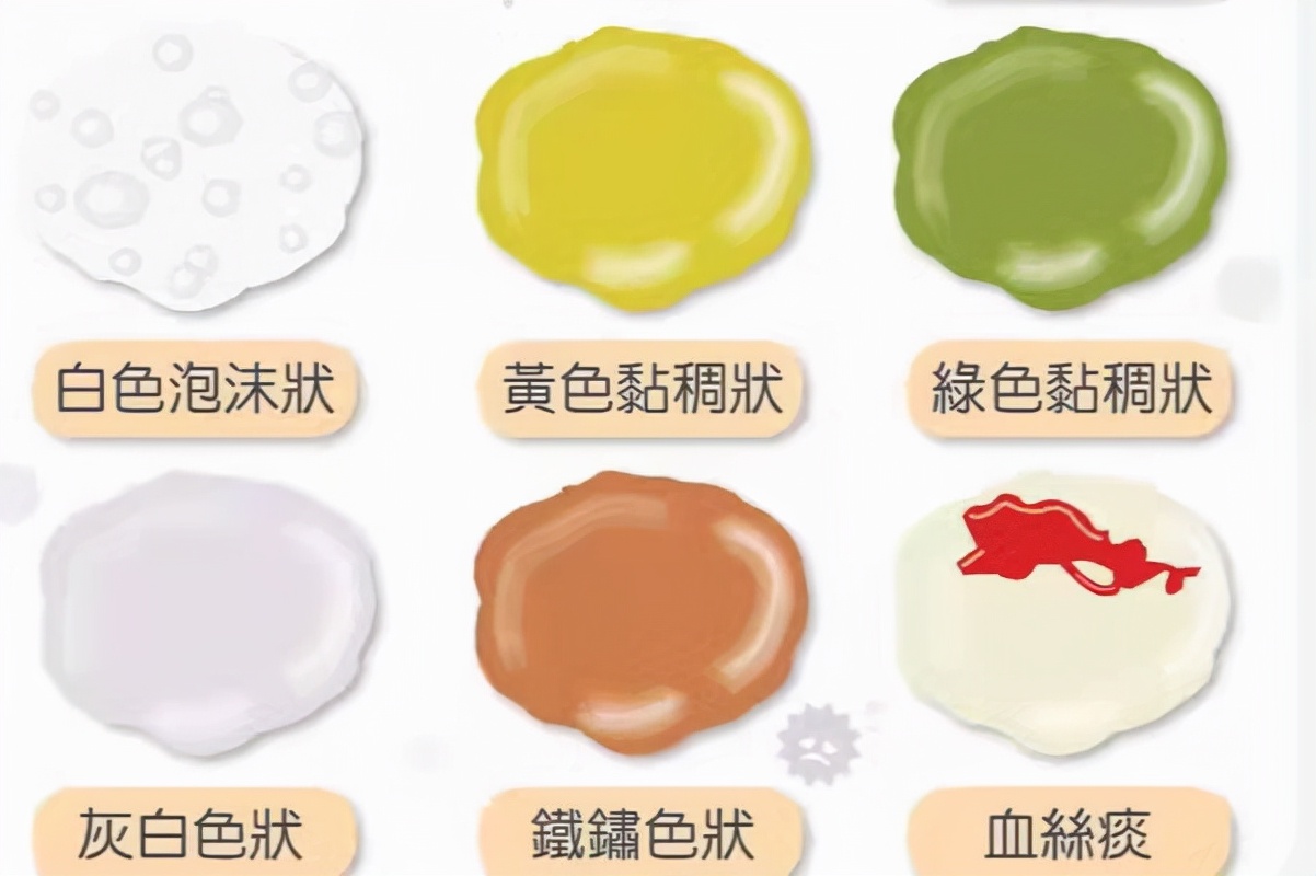 根据痰液颜色分辨肺炎类型，还不快快学起来