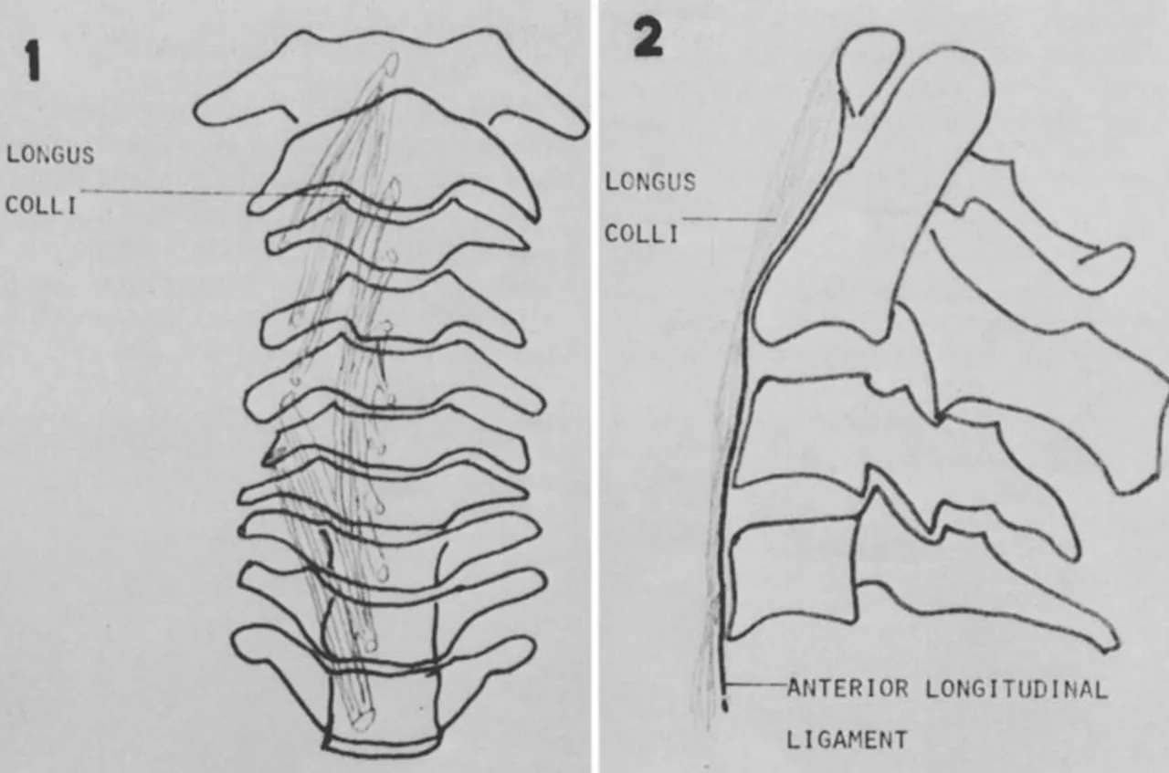 睡醒后脖子酸痛动不了怎么办,睡醒脖子痛不能扭头起身困难