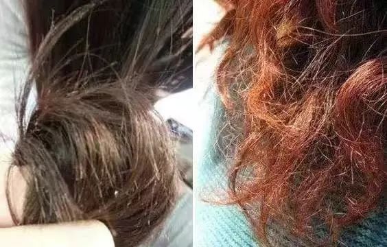 比较好用的德国防脱发,德国十大最好用的护肤品