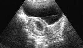 我明明开的是彩超,图像怎么是黑白的?