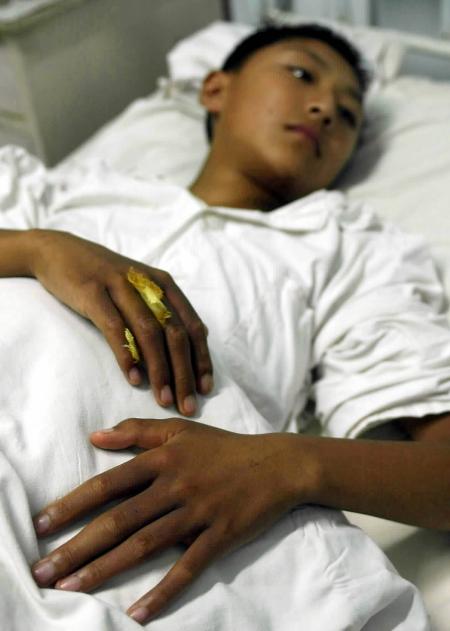 芥子气的可怕之处,芥子气是最毒的气体不