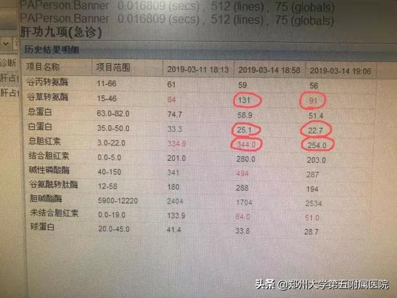 肝病患者血脂高用什么药,临床高胆固醇血症的治疗