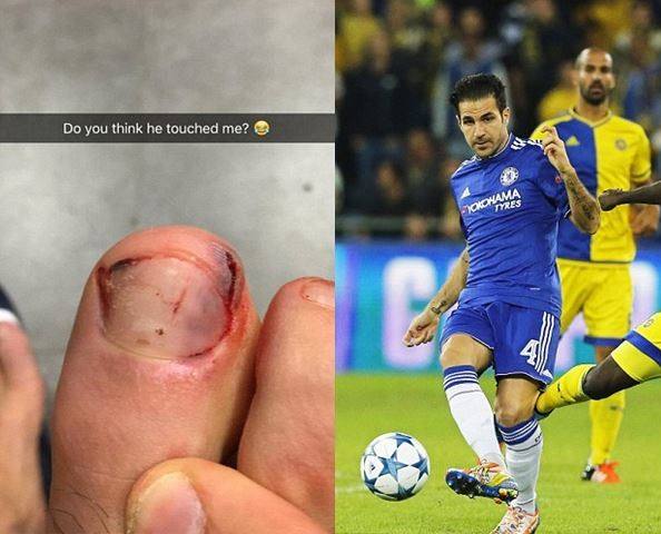 甲沟炎怎么办教你一招解决,甲沟炎怎么办用什么抗生素