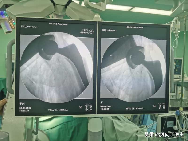 膝关节疼痛快一年了一直不敢蹲下,膝关节疼痛治疗期间反反复复