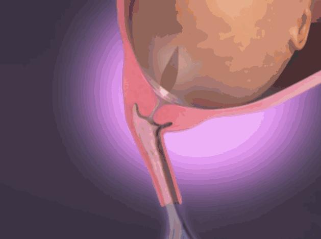 怀孕36周有少量液体流出是羊水吗,胎儿的尿液为什么叫羊水