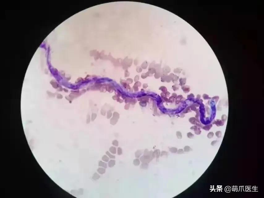 一只蚊子带来的灾难,一只蚊子毁了一个晚上的睡眠