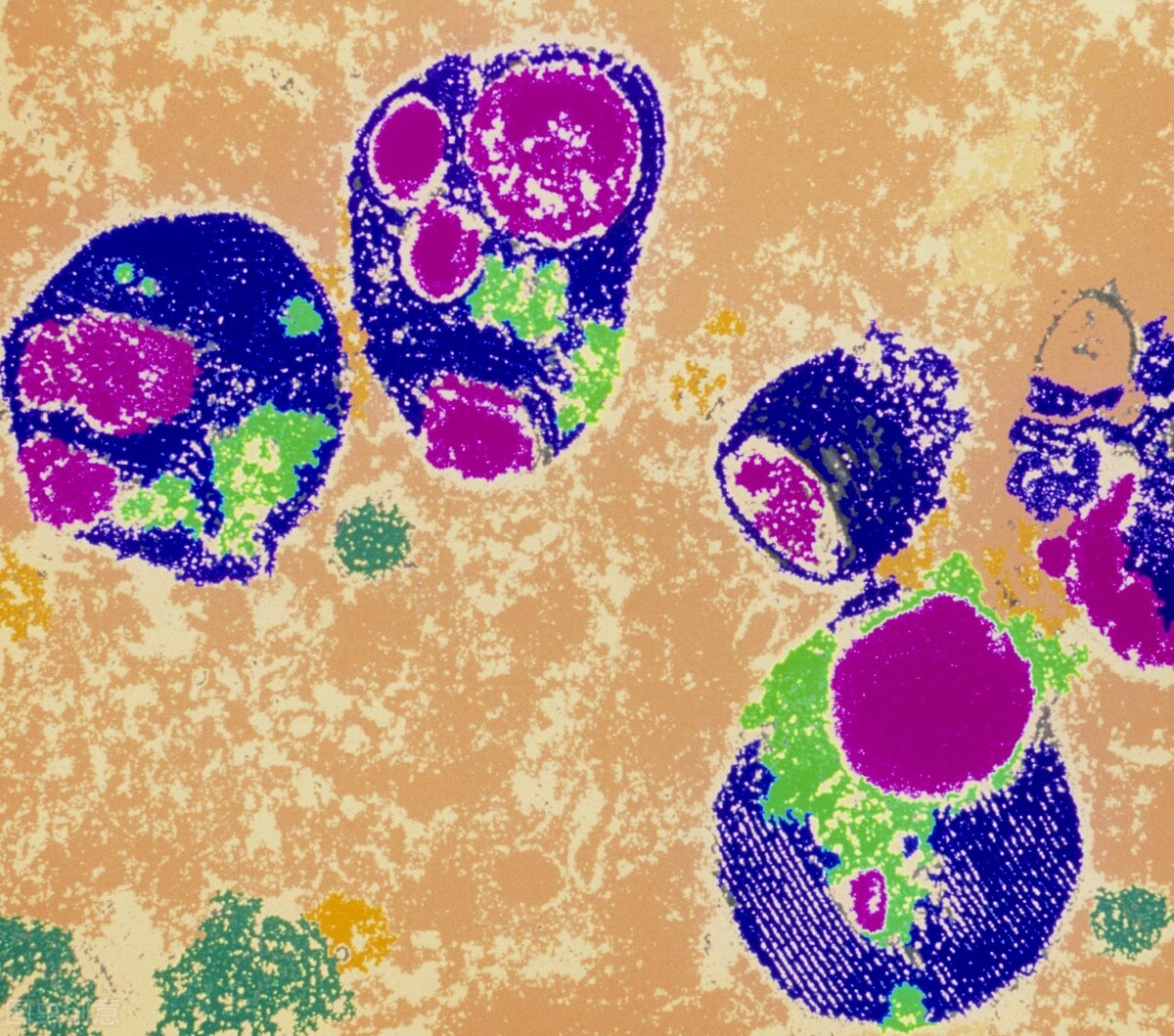 便秘喝肠清茶有帮助吗,便秘肠清茶