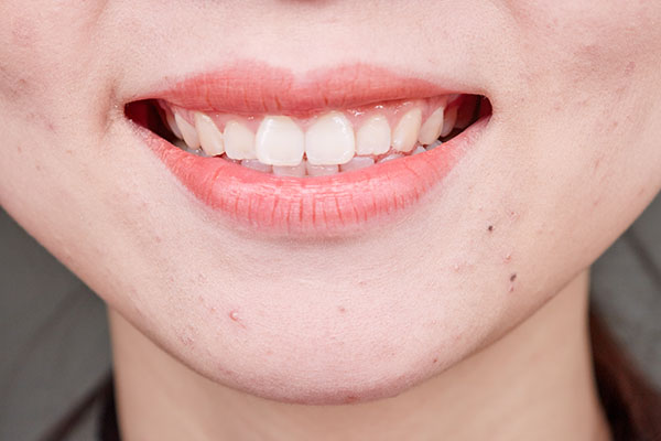 女汉子会不会长胡子,女生长胡子是一种什么样的体验