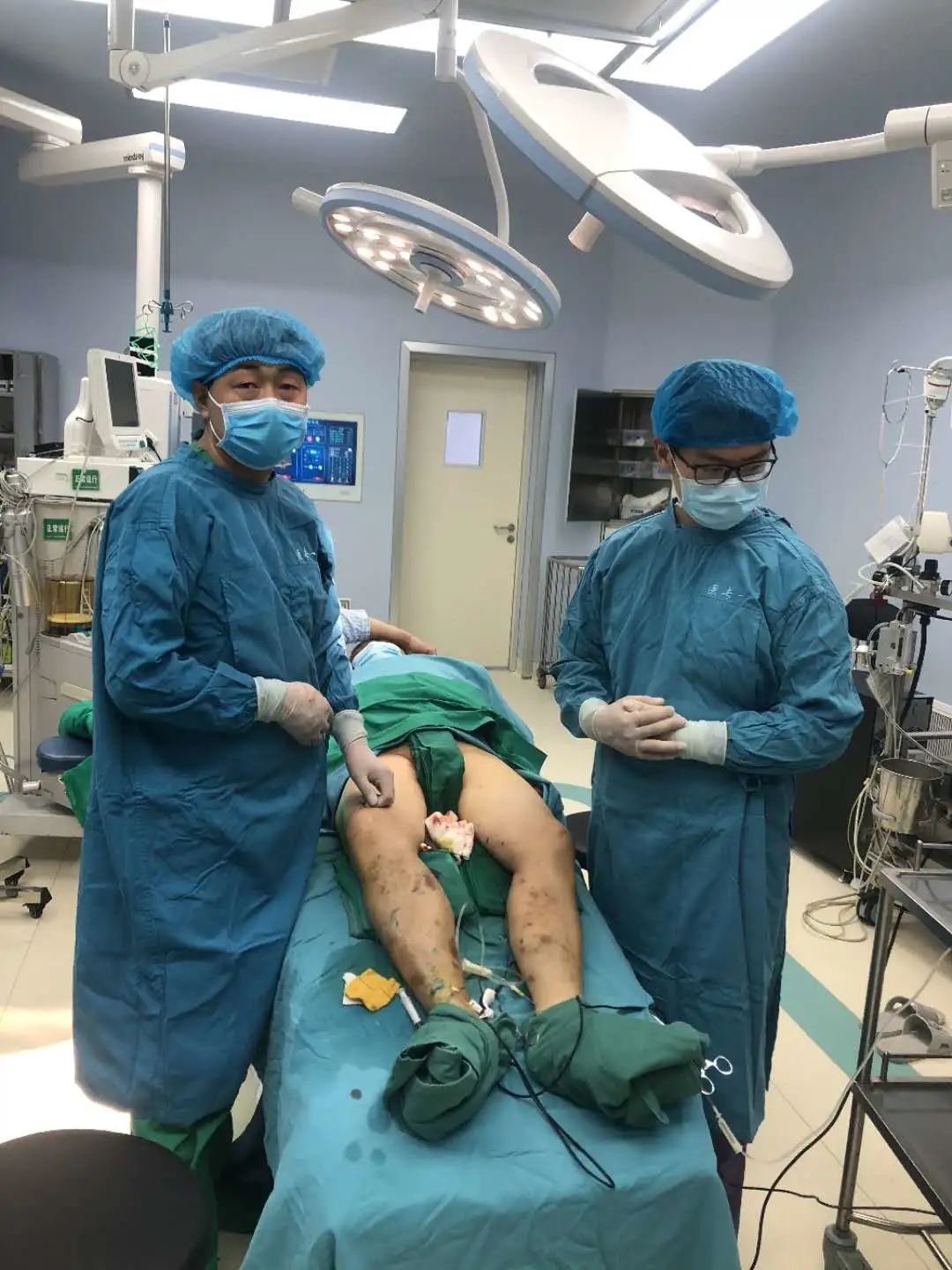 静脉曲张用空气波治疗仪,静脉曲张腔内激光治疗