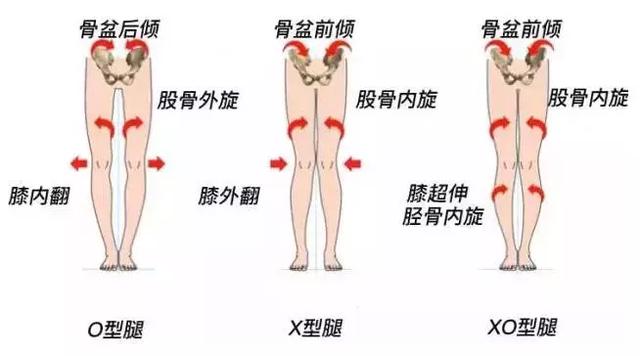 怎么改善又短又粗又不直的腿,小孩腿型矫正十种让腿变直的方法
