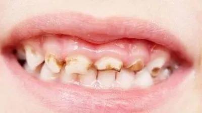 最新抽查酸奶质量前十名,袋装酸奶质量问题