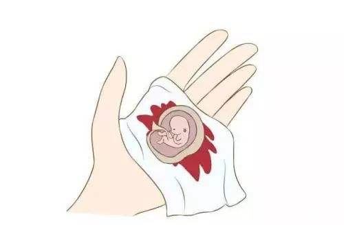 意外怀孕用药流？真的简单省事吗？专家告诉你真相